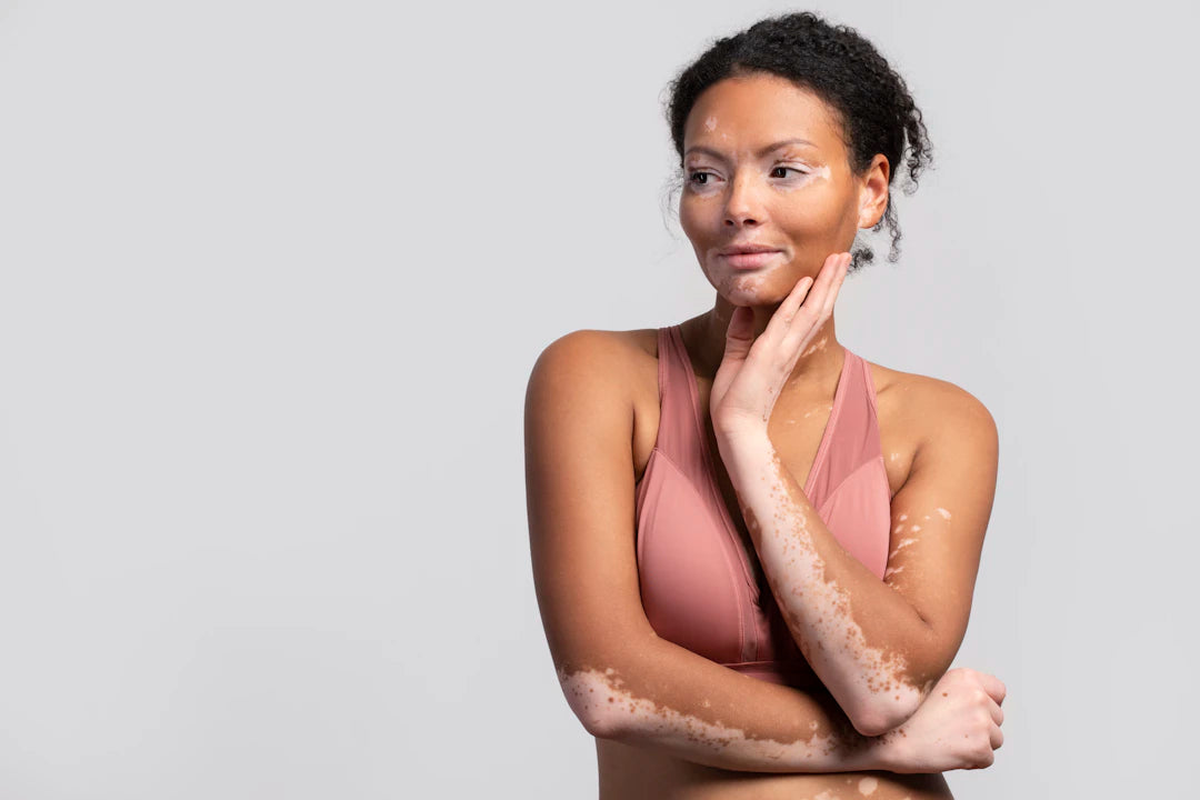 Suplementos Esenciales para Piel y Articulaciones en Mujeres 45